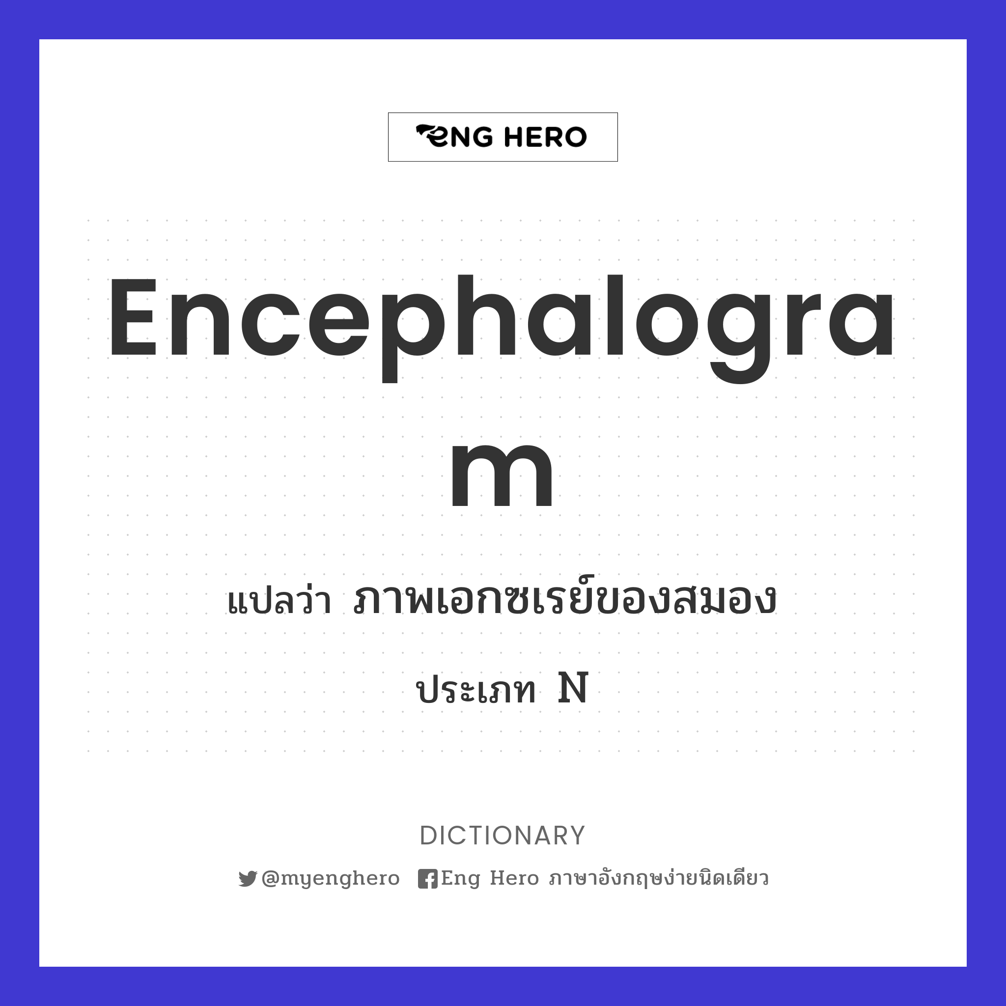 encephalogram