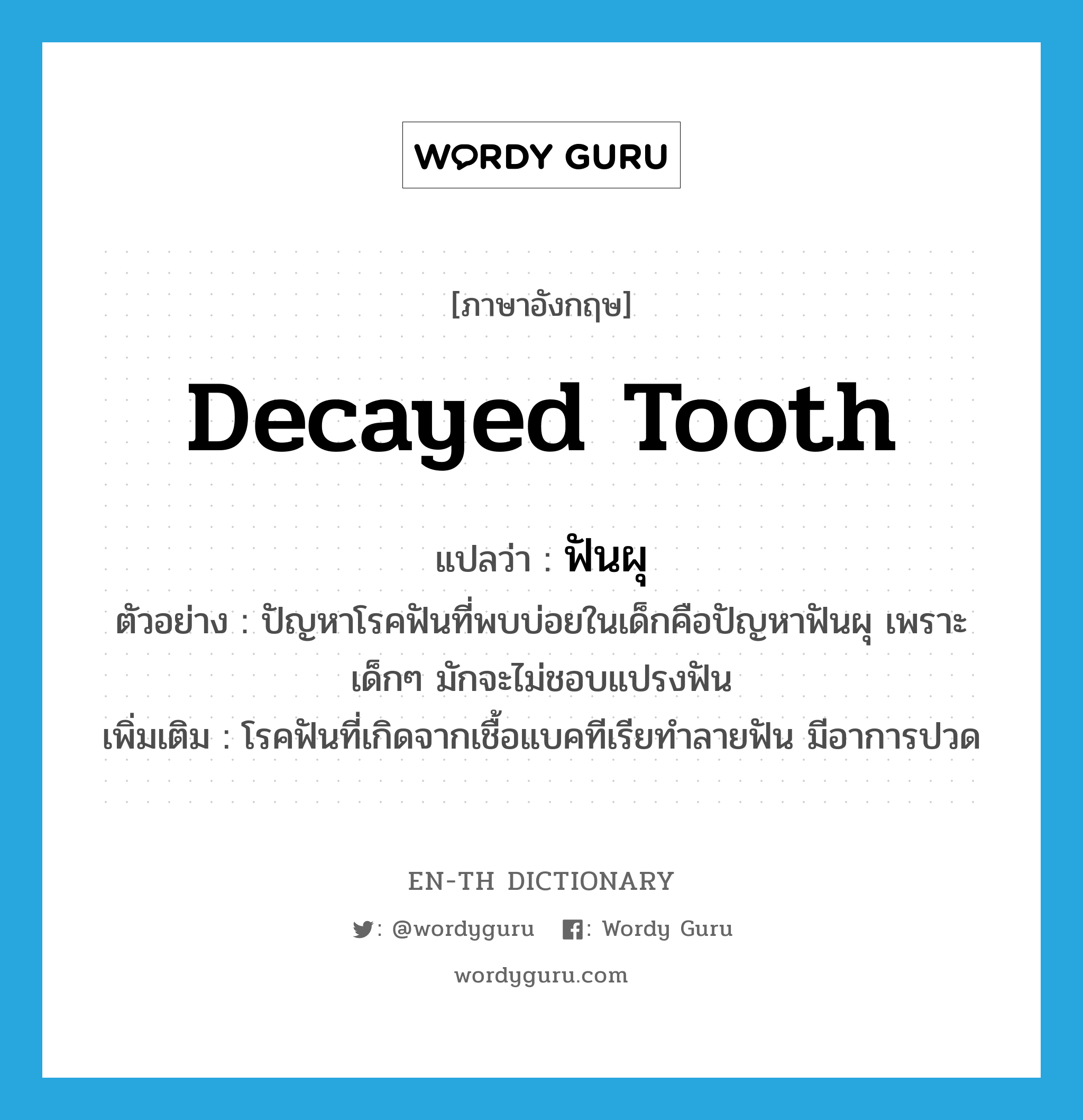 decayed tooth แปลว่า?, คำศัพท์ภาษาอังกฤษ decayed tooth แปลว่า ฟันผุ ประเภท N ตัวอย่าง ปัญหาโรคฟันที่พบบ่อยในเด็กคือปัญหาฟันผุ เพราะเด็กๆ มักจะไม่ชอบแปรงฟัน เพิ่มเติม โรคฟันที่เกิดจากเชื้อแบคทีเรียทำลายฟัน มีอาการปวด หมวด N