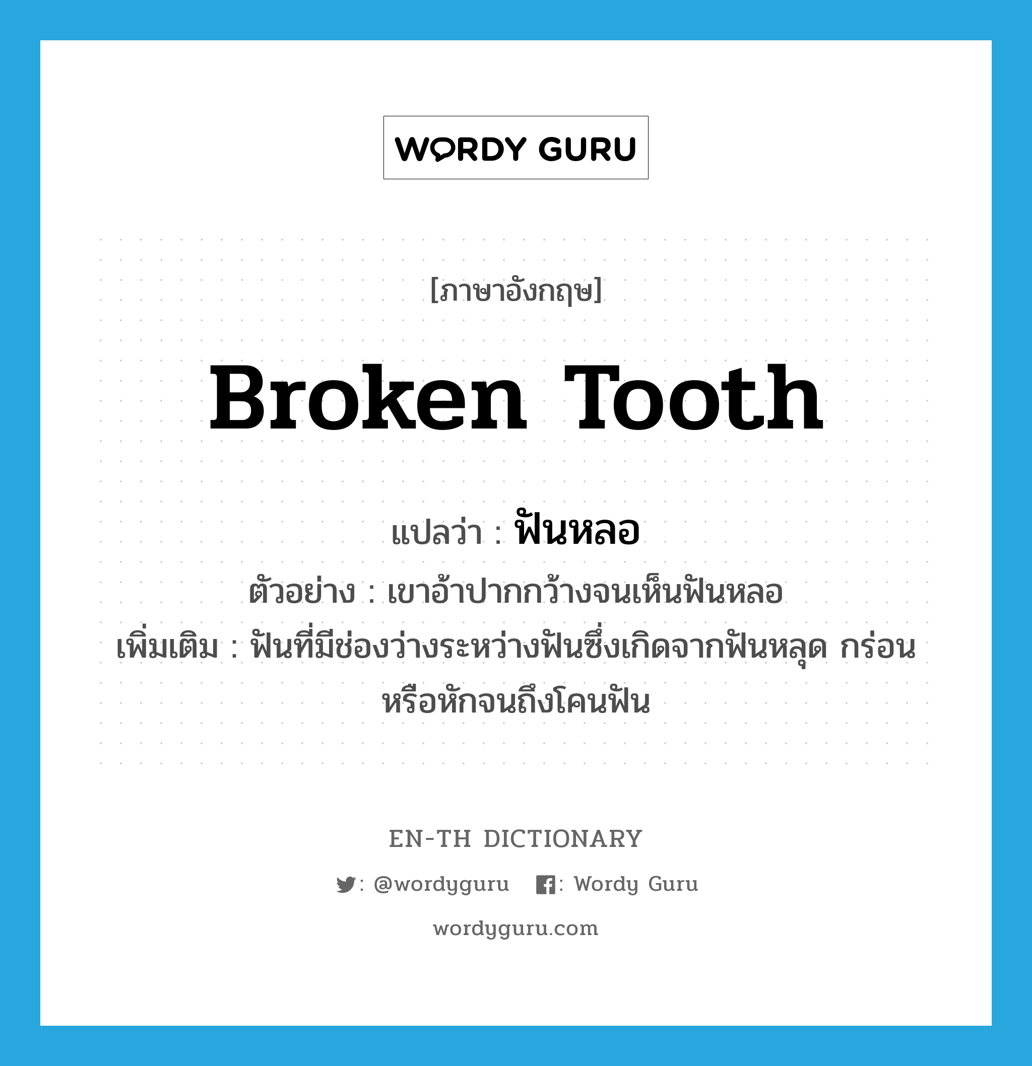 broken tooth แปลว่า?, คำศัพท์ภาษาอังกฤษ broken tooth แปลว่า ฟันหลอ ประเภท N ตัวอย่าง เขาอ้าปากกว้างจนเห็นฟันหลอ เพิ่มเติม ฟันที่มีช่องว่างระหว่างฟันซึ่งเกิดจากฟันหลุด กร่อน หรือหักจนถึงโคนฟัน หมวด N
