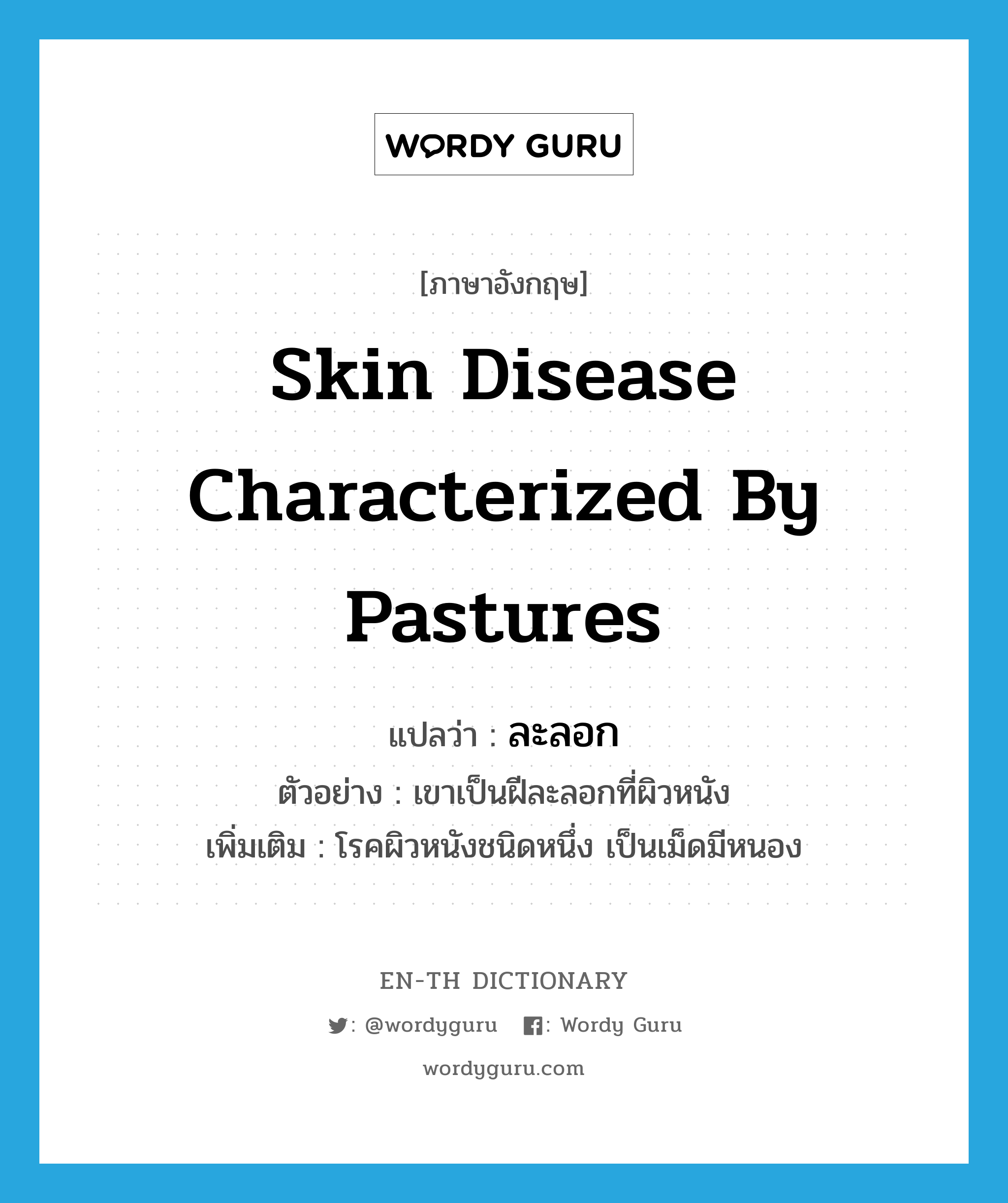 skin disease characterized by pastures แปลว่า?, คำศัพท์ภาษาอังกฤษ skin disease characterized by pastures แปลว่า ละลอก ประเภท N ตัวอย่าง เขาเป็นฝีละลอกที่ผิวหนัง เพิ่มเติม โรคผิวหนังชนิดหนึ่ง เป็นเม็ดมีหนอง หมวด N