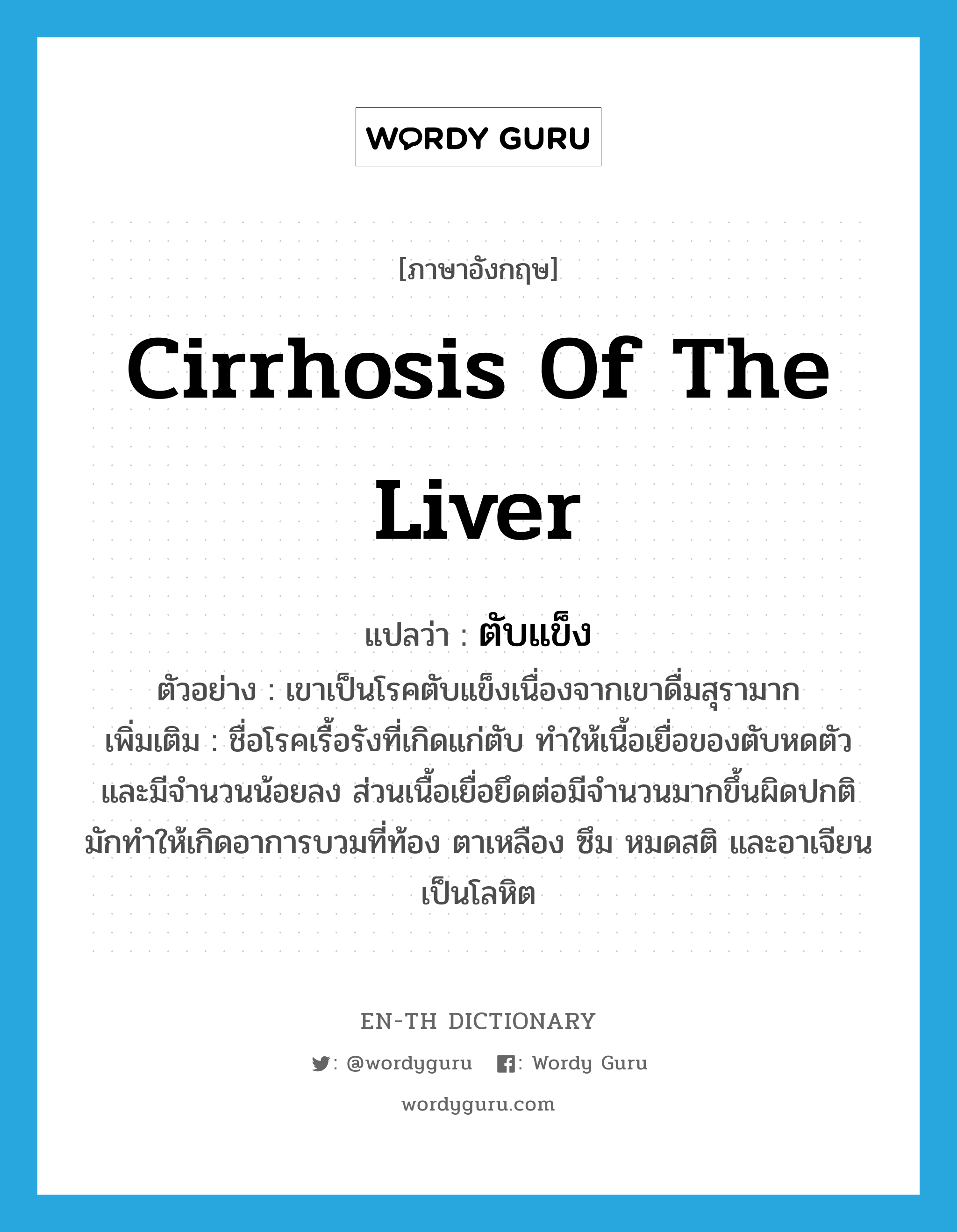 ตับแข็ง ภาษาอังกฤษ?, คำศัพท์ภาษาอังกฤษ ตับแข็ง แปลว่า cirrhosis of the liver ประเภท N ตัวอย่าง เขาเป็นโรคตับแข็งเนื่องจากเขาดื่มสุรามาก เพิ่มเติม ชื่อโรคเรื้อรังที่เกิดแก่ตับ ทำให้เนื้อเยื่อของตับหดตัวและมีจำนวนน้อยลง ส่วนเนื้อเยื่อยึดต่อมีจำนวนมากขึ้นผิดปกติ มักทำให้เกิดอาการบวมที่ท้อง ตาเหลือง ซึม หมดสติ และอาเจียนเป็นโลหิต หมวด N