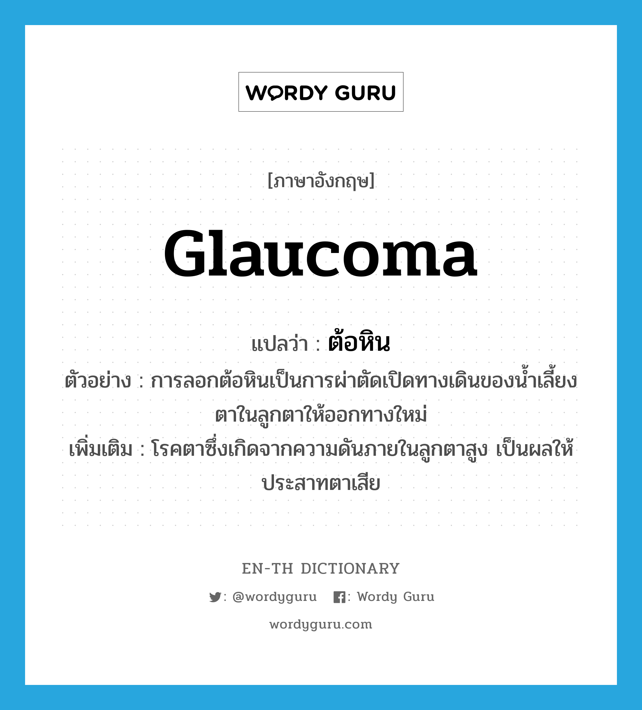 ต้อหิน ภาษาอังกฤษ?, คำศัพท์ภาษาอังกฤษ ต้อหิน แปลว่า glaucoma ประเภท N ตัวอย่าง การลอกต้อหินเป็นการผ่าตัดเปิดทางเดินของน้ำเลี้ยงตาในลูกตาให้ออกทางใหม่ เพิ่มเติม โรคตาซึ่งเกิดจากความดันภายในลูกตาสูง เป็นผลให้ประสาทตาเสีย หมวด N