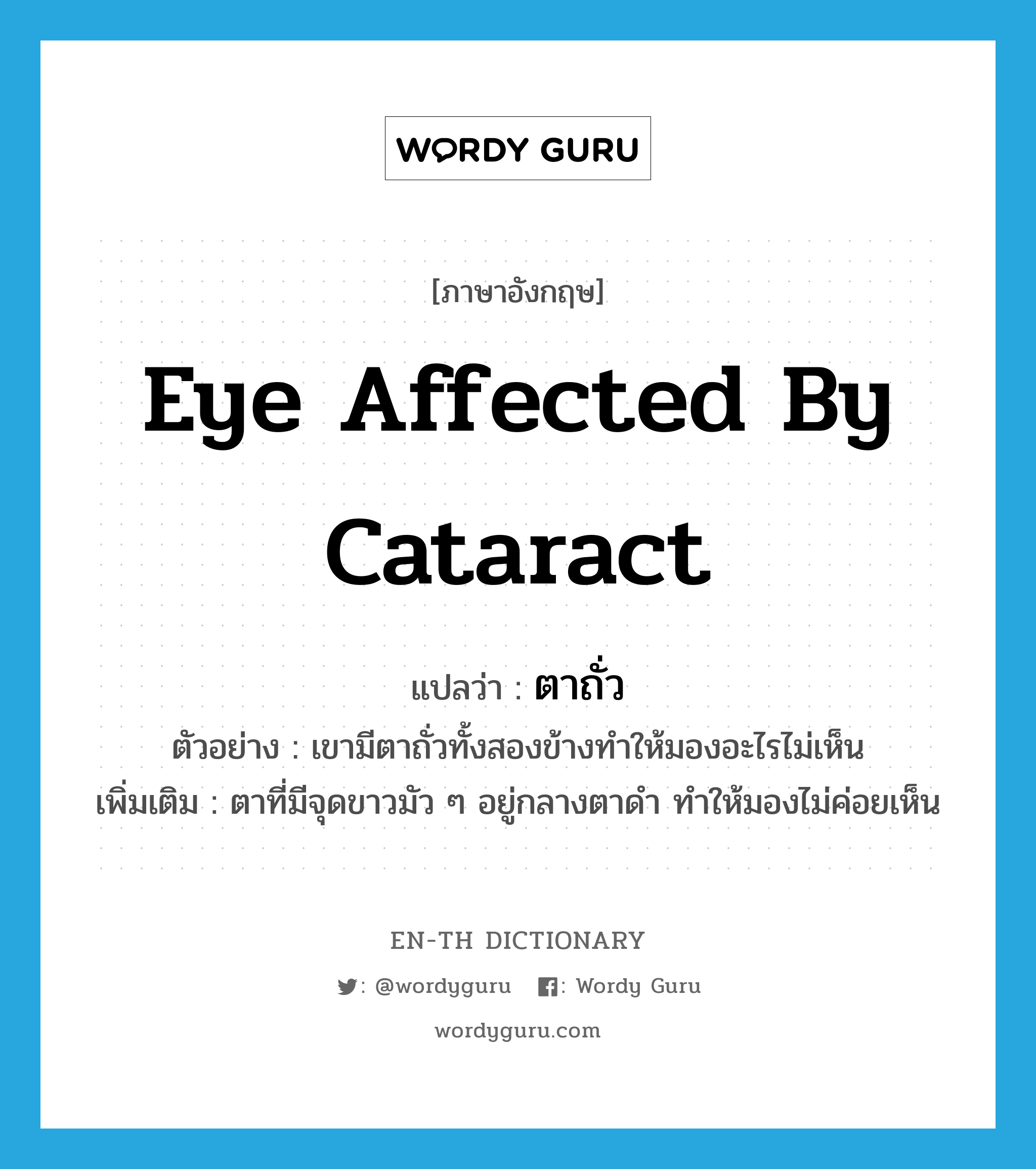 eye affected by cataract แปลว่า?, คำศัพท์ภาษาอังกฤษ eye affected by cataract แปลว่า ตาถั่ว ประเภท N ตัวอย่าง เขามีตาถั่วทั้งสองข้างทำให้มองอะไรไม่เห็น เพิ่มเติม ตาที่มีจุดขาวมัว ๆ อยู่กลางตาดำ ทำให้มองไม่ค่อยเห็น หมวด N