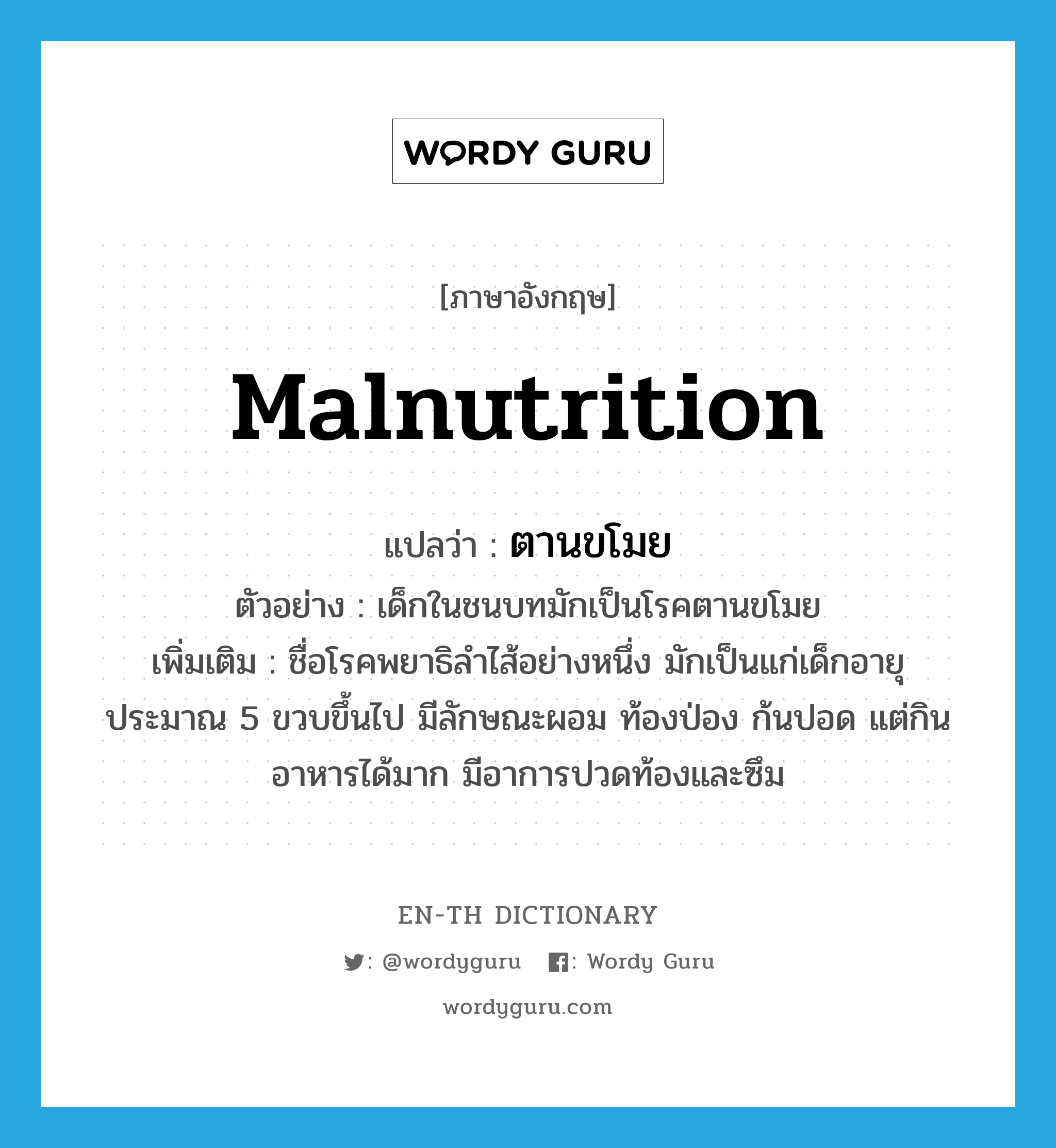 malnutrition แปลว่า?, คำศัพท์ภาษาอังกฤษ malnutrition แปลว่า ตานขโมย ประเภท N ตัวอย่าง เด็กในชนบทมักเป็นโรคตานขโมย เพิ่มเติม ชื่อโรคพยาธิลำไส้อย่างหนึ่ง มักเป็นแก่เด็กอายุประมาณ 5 ขวบขึ้นไป มีลักษณะผอม ท้องป่อง ก้นปอด แต่กินอาหารได้มาก มีอาการปวดท้องและซึม หมวด N