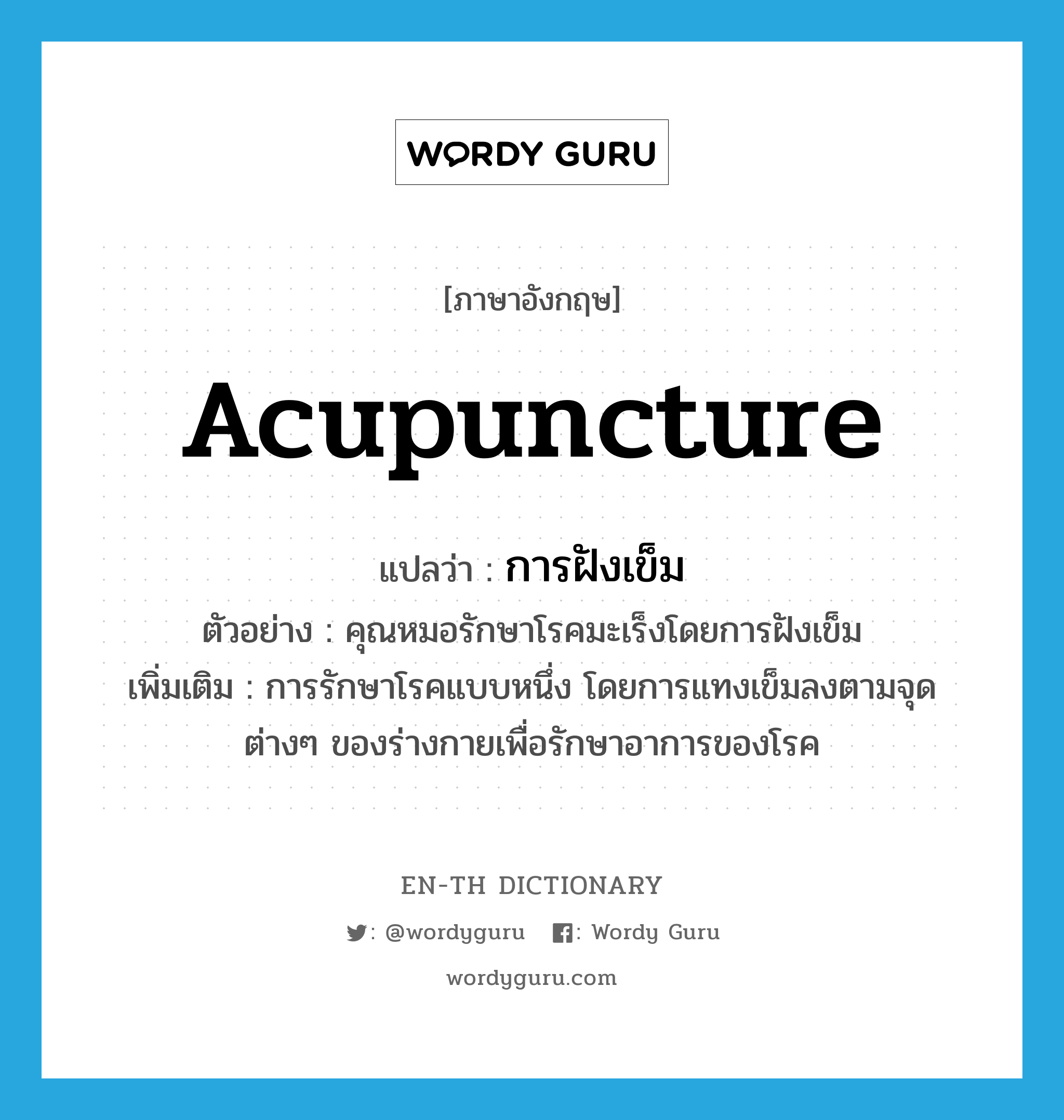 acupuncture แปลว่า?, คำศัพท์ภาษาอังกฤษ acupuncture แปลว่า การฝังเข็ม ประเภท N ตัวอย่าง คุณหมอรักษาโรคมะเร็งโดยการฝังเข็ม เพิ่มเติม การรักษาโรคแบบหนึ่ง โดยการแทงเข็มลงตามจุดต่างๆ ของร่างกายเพื่อรักษาอาการของโรค หมวด N