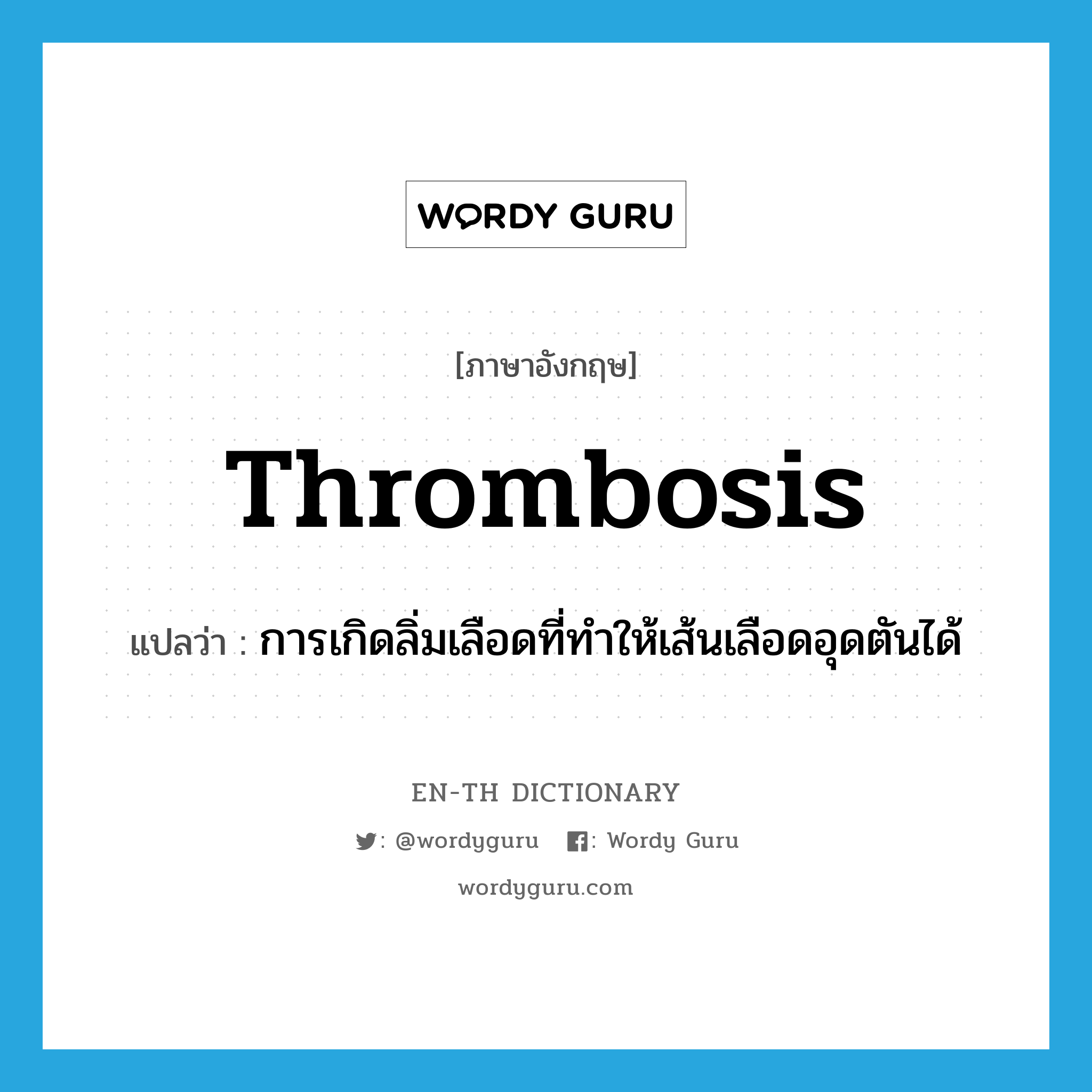 thrombosis แปลว่า?, คำศัพท์ภาษาอังกฤษ thrombosis แปลว่า การเกิดลิ่มเลือดที่ทำให้เส้นเลือดอุดตันได้ ประเภท N หมวด N