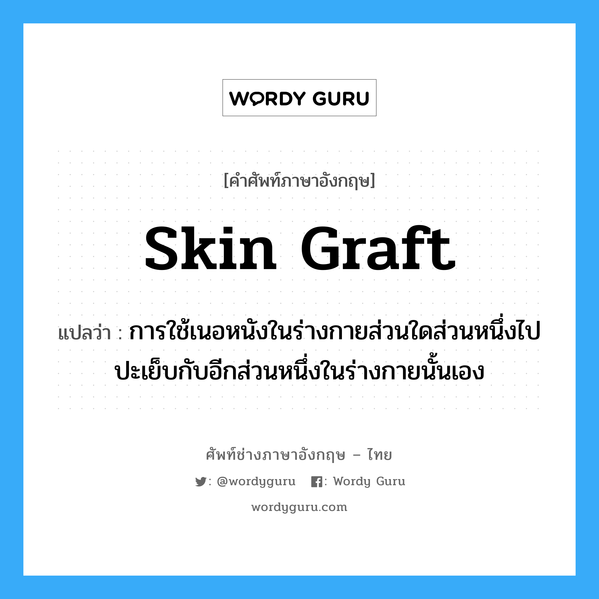 skin graft แปลว่า?, คำศัพท์ช่างภาษาอังกฤษ - ไทย skin graft คำศัพท์ภาษาอังกฤษ skin graft แปลว่า การใช้เนอหนังในร่างกายส่วนใดส่วนหนึ่งไปปะเย็บกับอีกส่วนหนึ่งในร่างกายนั้นเอง